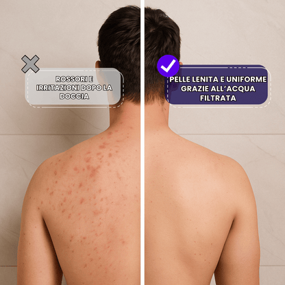 PureFlow - Doccino Anticalcare